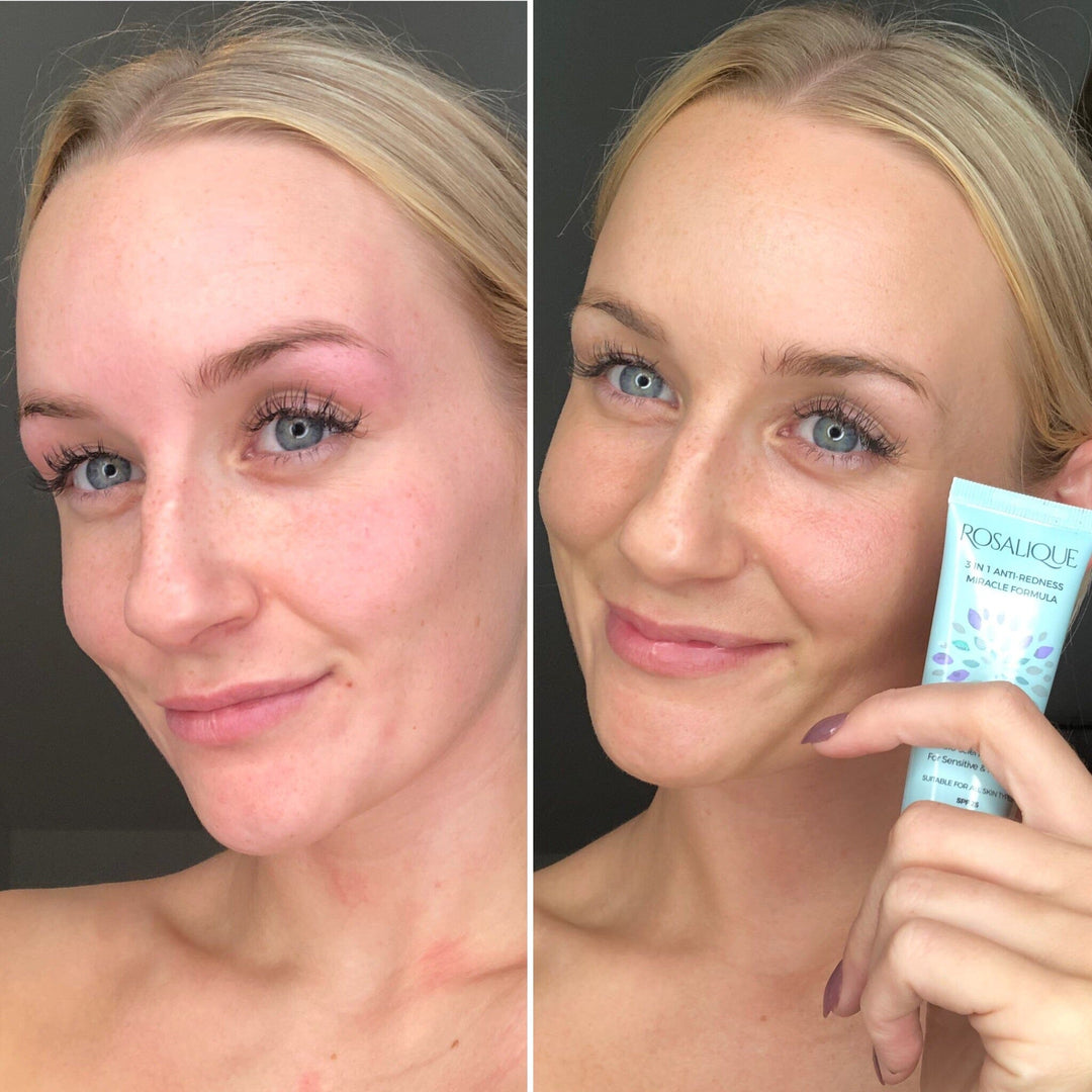 Rosalique - Dagcreme 3 i 1 - 30 ml Creme